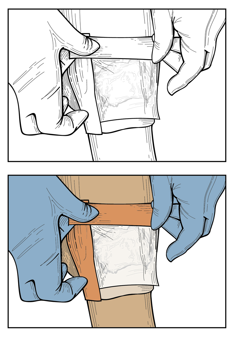 Medical Illustration